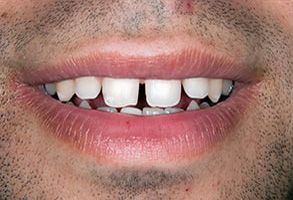 Michael Korngold, DDS | Teeth Whitening, Pediatric Dentistry and Dentures